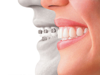 Amarillo Super Smiles For Kids | Sedation Dentistry, Invisalign reg and Exams Cleanings