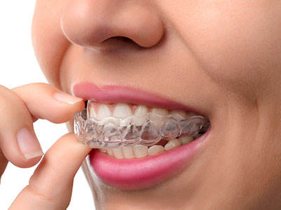 Amarillo Super Smiles For Kids | Traditional Metal Braces, Pulpotomy and Your Child s First Dental Visit